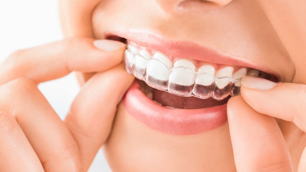 Harmonieschiene AB Zahnärzte Bonn